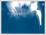 Post Operative Radiograph